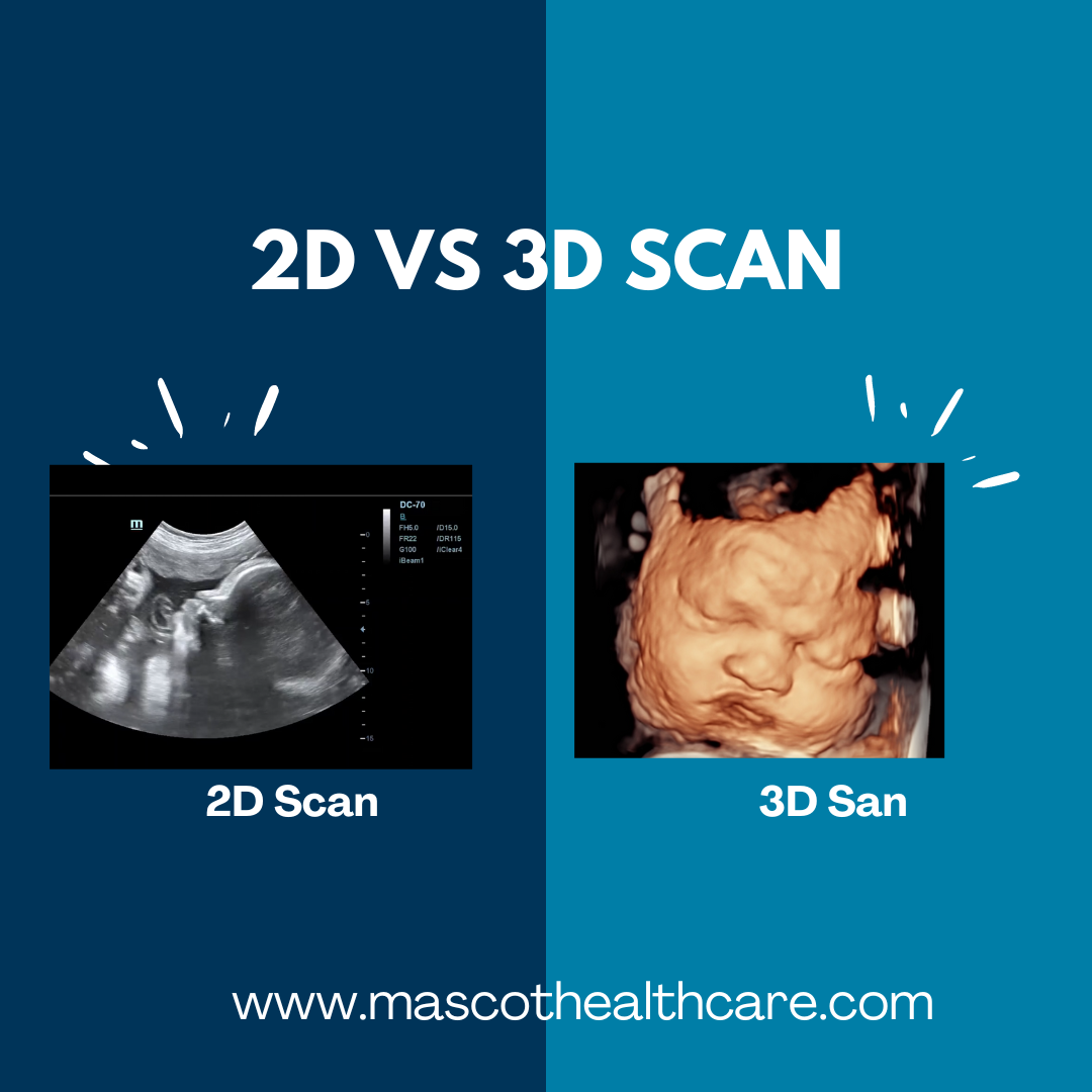 2d and 3d scan of a fetus