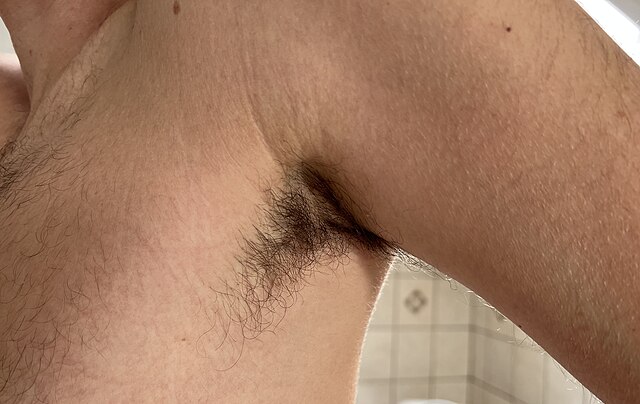 Causes and Prevention of Bad Body Odour